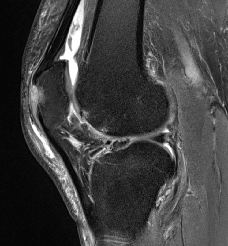 Figure 3 for case gout arthritis ( RID3567 )